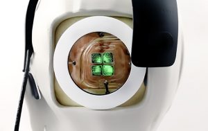 Prótesis de visión cortical formada por una cámara, un transmisor inalámbrico y una unidad de procesamiento de visión