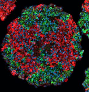 Islote derivado de células madre. Células beta que producen insulina marcadas en rojo y células alfa que producen glucagón en verde. / Väinö Lithoviu (Universidad de Helsinki)